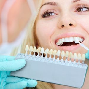 Dental tooth whitening